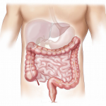 Colostomía