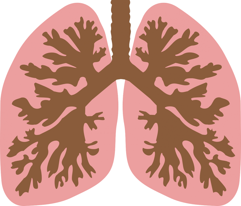 Derrame pleural