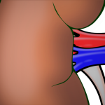 Litiasis renal