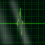 Electrocardiograma