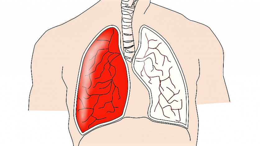 Enfisema